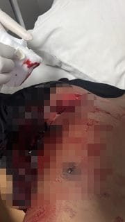 Perkelahian Berubah Maut, Empat Anggota Brimob Jadi Korban Penusukan Beruntun