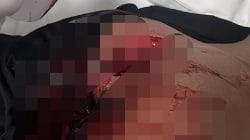 Perkelahian Berubah Maut, Empat Anggota Brimob Jadi Korban Penusukan Beruntun
