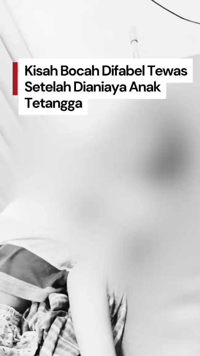 Kronologi Meninggalnya Anak Berkebutuhan Khusus di Surabaya